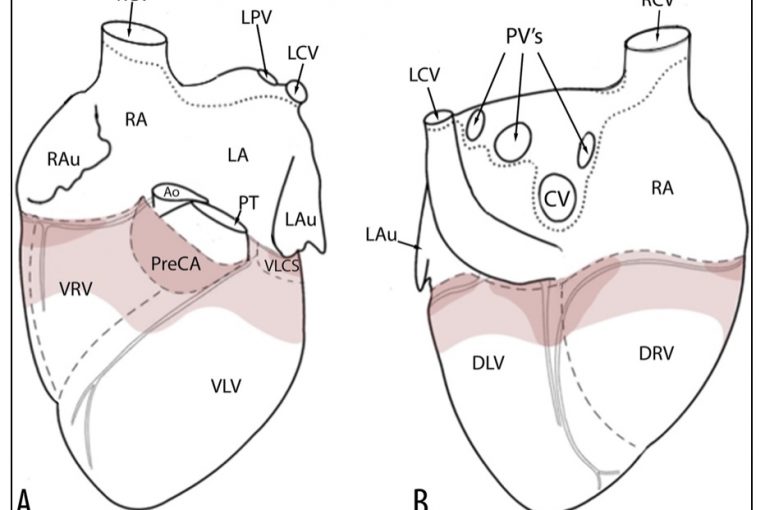 Anatomical drawing of the heart from two different angles